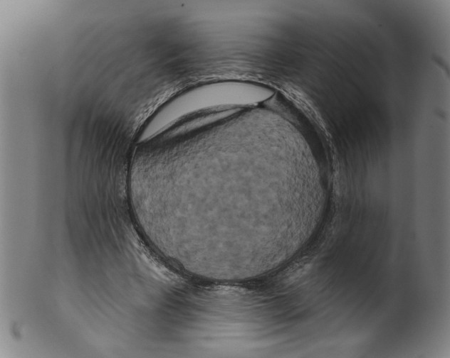 X0000099420393200806061000