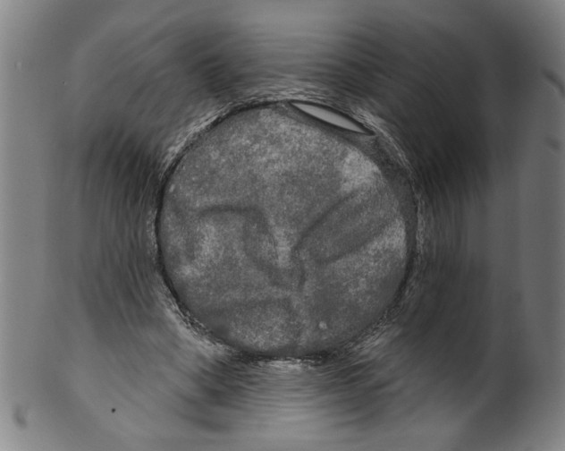 X0000099420394200806061000