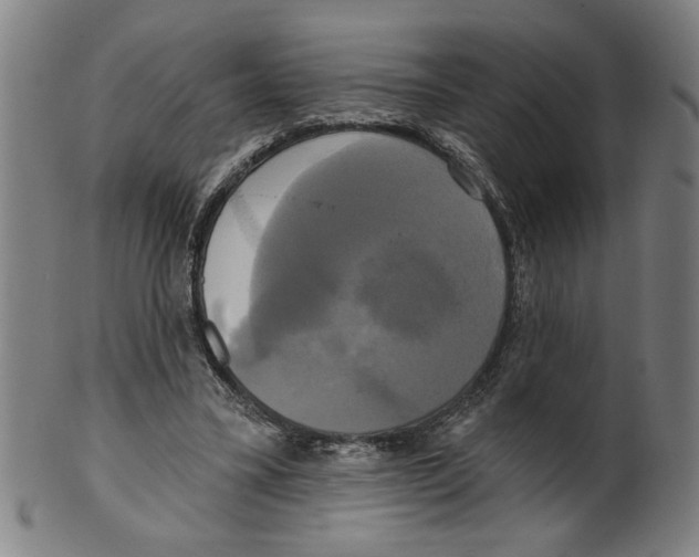 X0000099420395200806061000