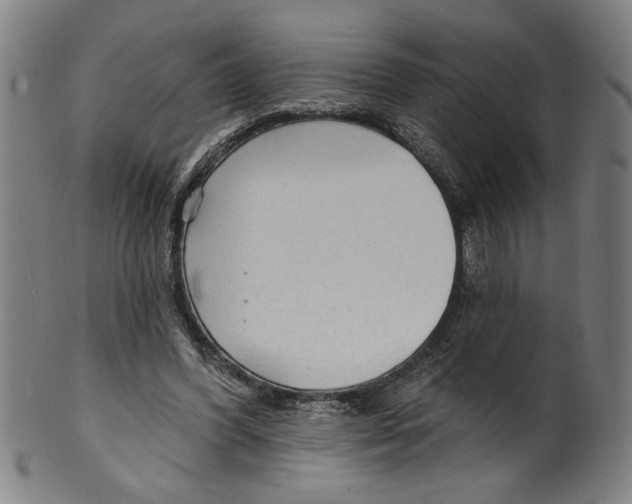 X0000099420396200806061000