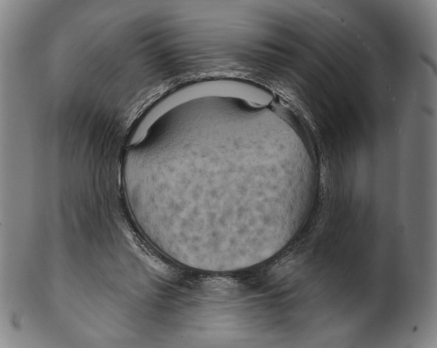 X0000099420397200806061000