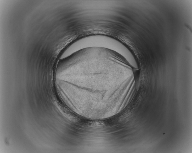 X0000099420398200806061000