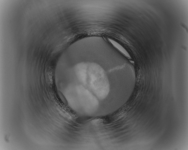 X0000099420452200806060959