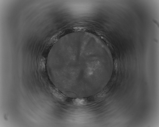 X0000099420570200806060958
