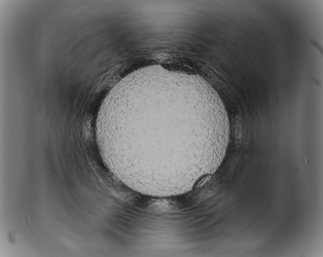 X0000099420611200806060956