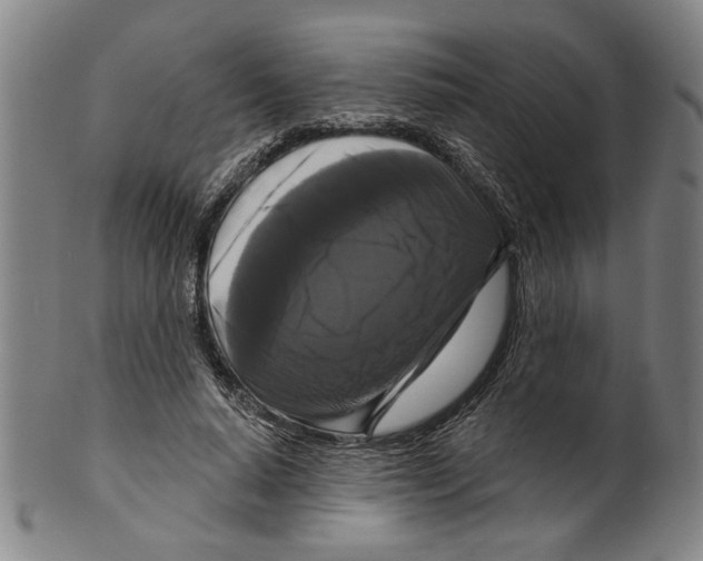 X0000099420640200806060956