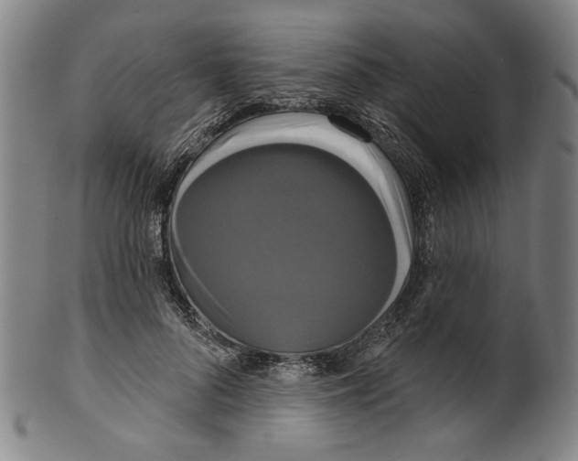 X0000099420696200806060955