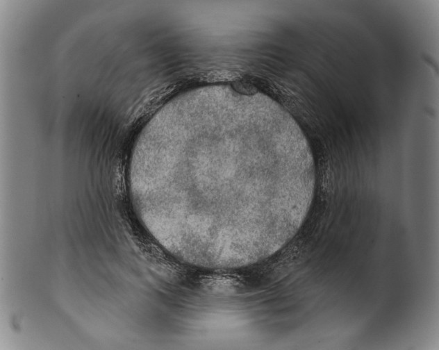 X0000099420743200806060954
