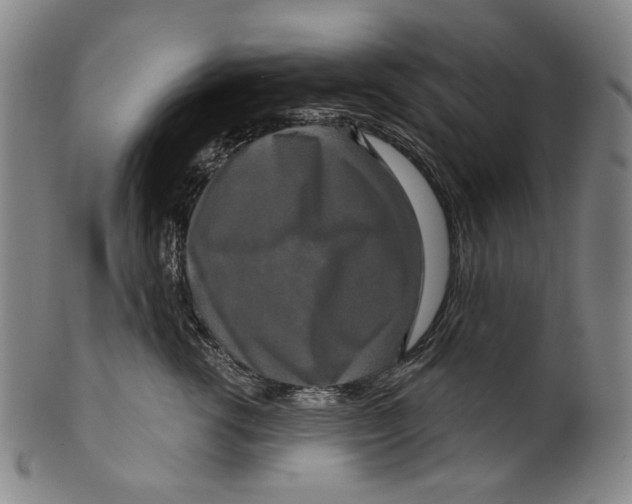 X0000099420762200806060955