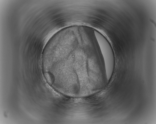 X0000099420903200806060952