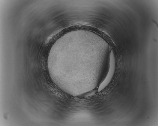 X0000099420919200806060951