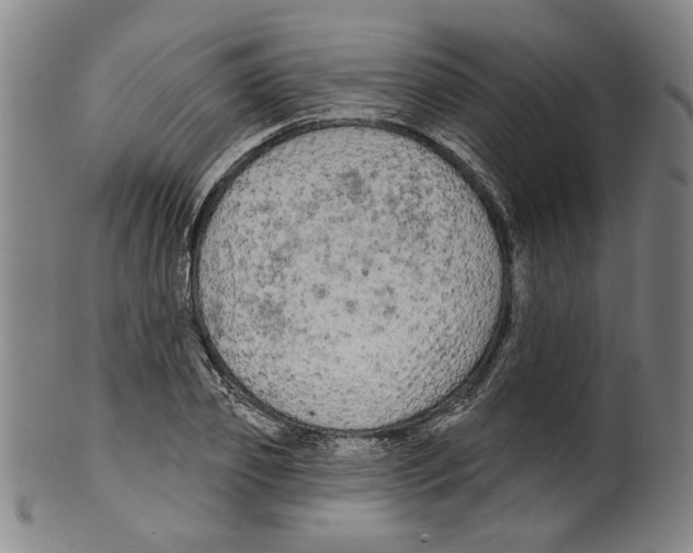 X0000099420933200806060952