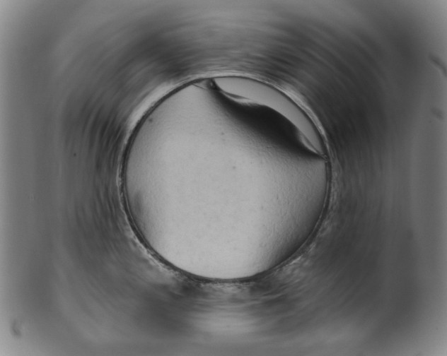 X0000099421197200806060948
