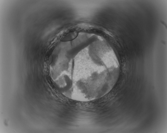 X0000099421397200806060944