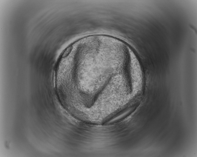 X0000099421510200806060943