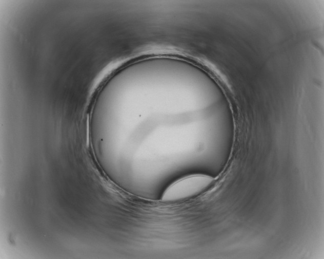 X0000099431175200805090720