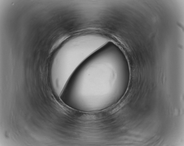 X0000099431402200805090717