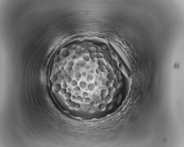 X0000099430002200805161121