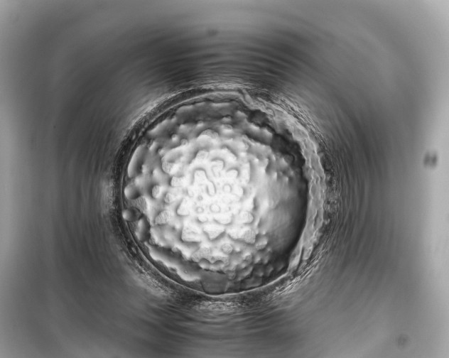 X0000099430351200805161115