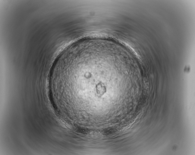 X0000099430487200805161114