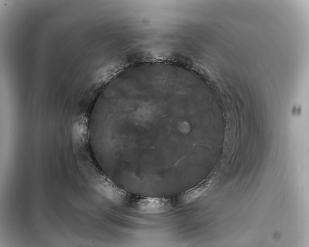 X0000099430672200805161111