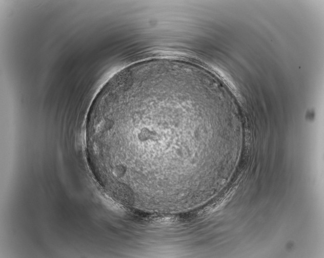 X0000099430891200805161107