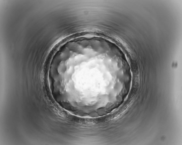 X0000099430975200805161106