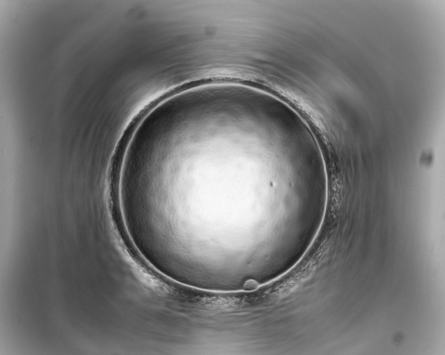 X0000099430991200805161106