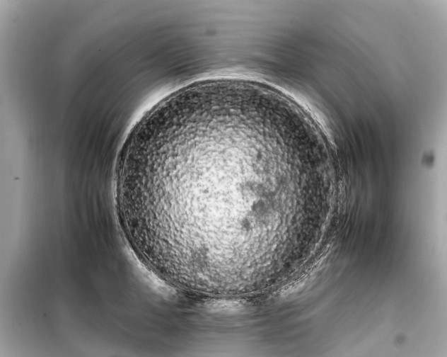 X0000099430998200805161106