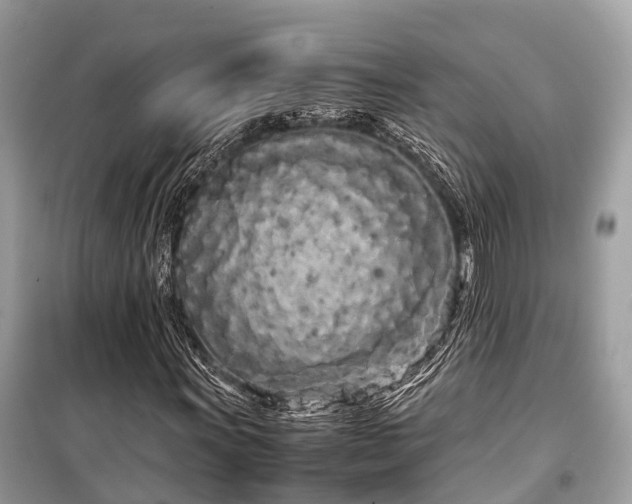 X0000099431011200805161105