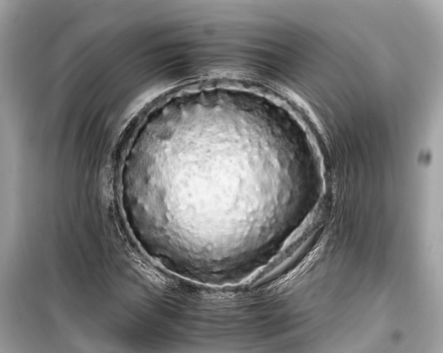 X0000099431019200805161105