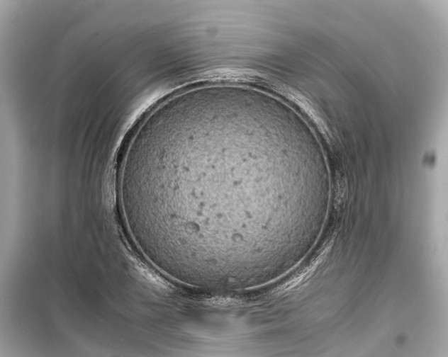 X0000099431075200805161105