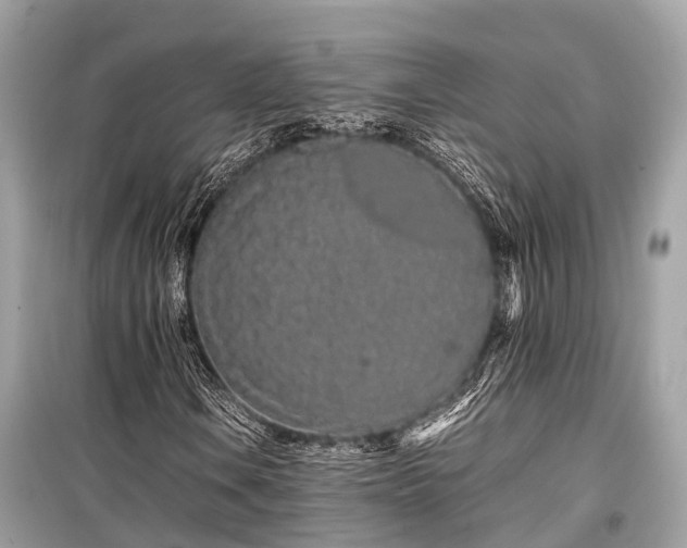 X0000099431106200805161104