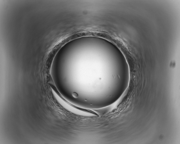 X0000099431159200805161103