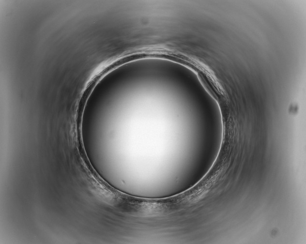 X0000099431176200805161103