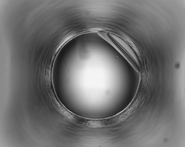 X0000099431194200805161103