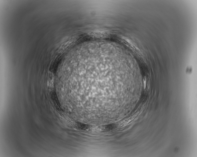 X0000099431251200805161102