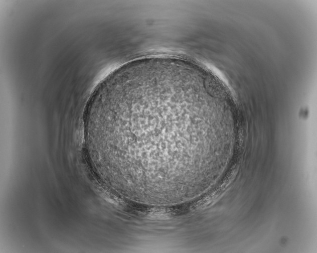 X0000099431267200805161101