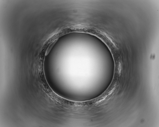 X0000099431350200805161100
