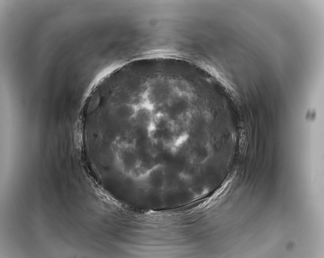 X0000099431358200805161100