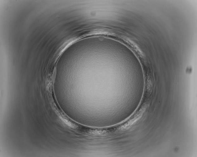 X0000099431369200805161100