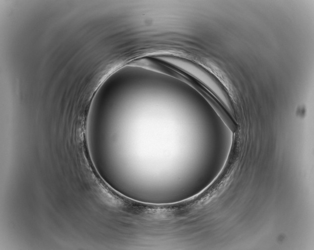 X0000099431377200805161100