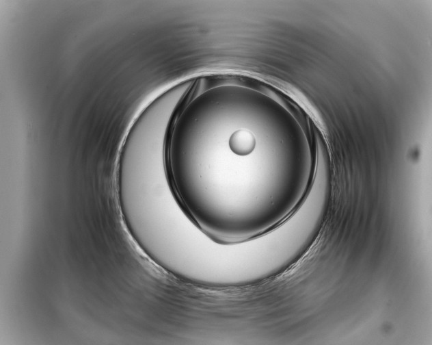 X0000099431388200805161100