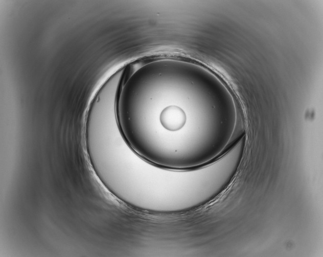 X0000099431392200805161100