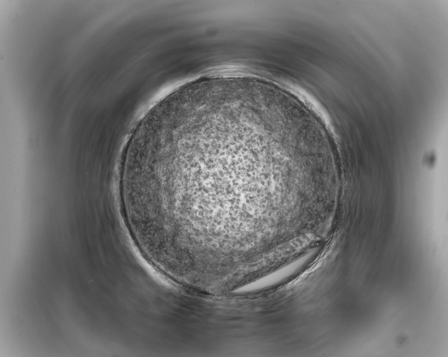 X0000099431429200805161059