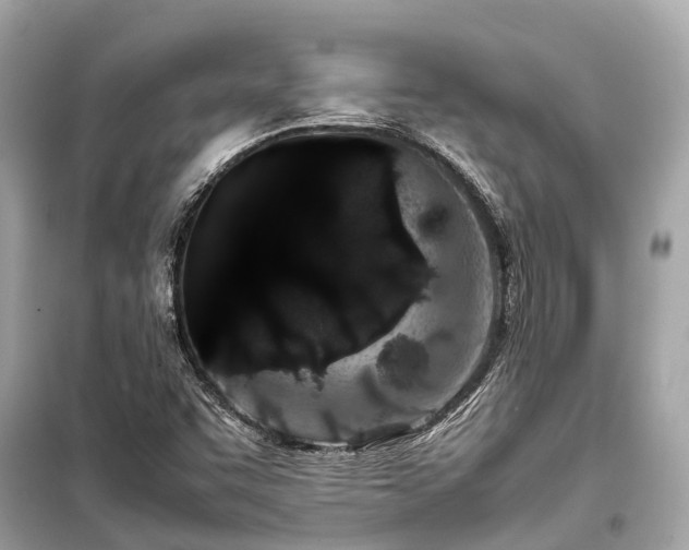 X0000099431455200805161058