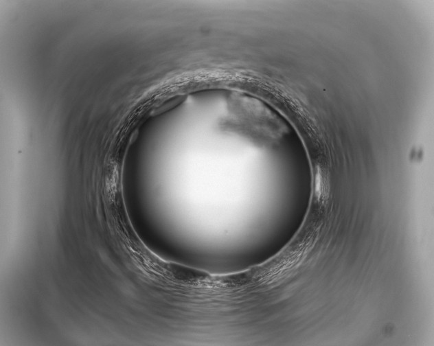 X0000099431492200805161057