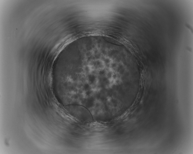 X0000099430290200805231700