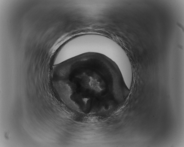 X0000099430295200805231700