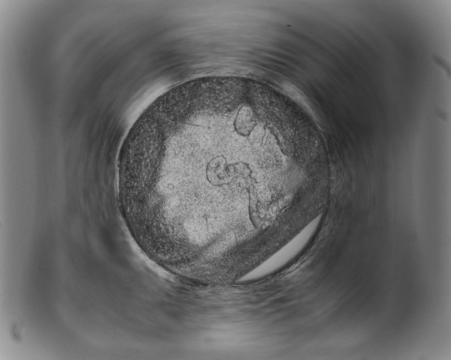 X0000099431095200805231647